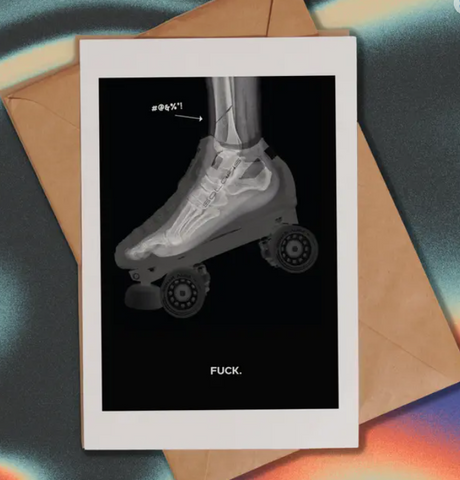 broke bone skate card